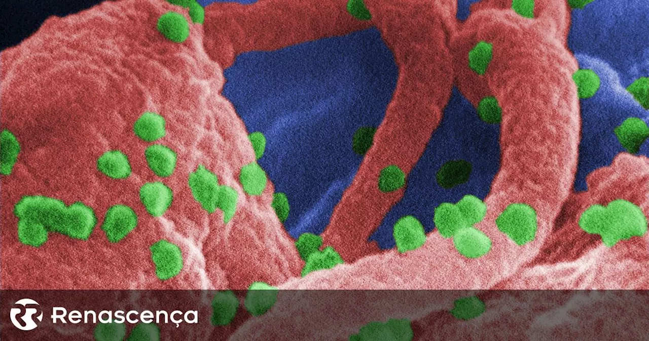 Relatório DGS Indica Maior Proporção de Casos de HIV e SIDA na Comunidade Imigrante