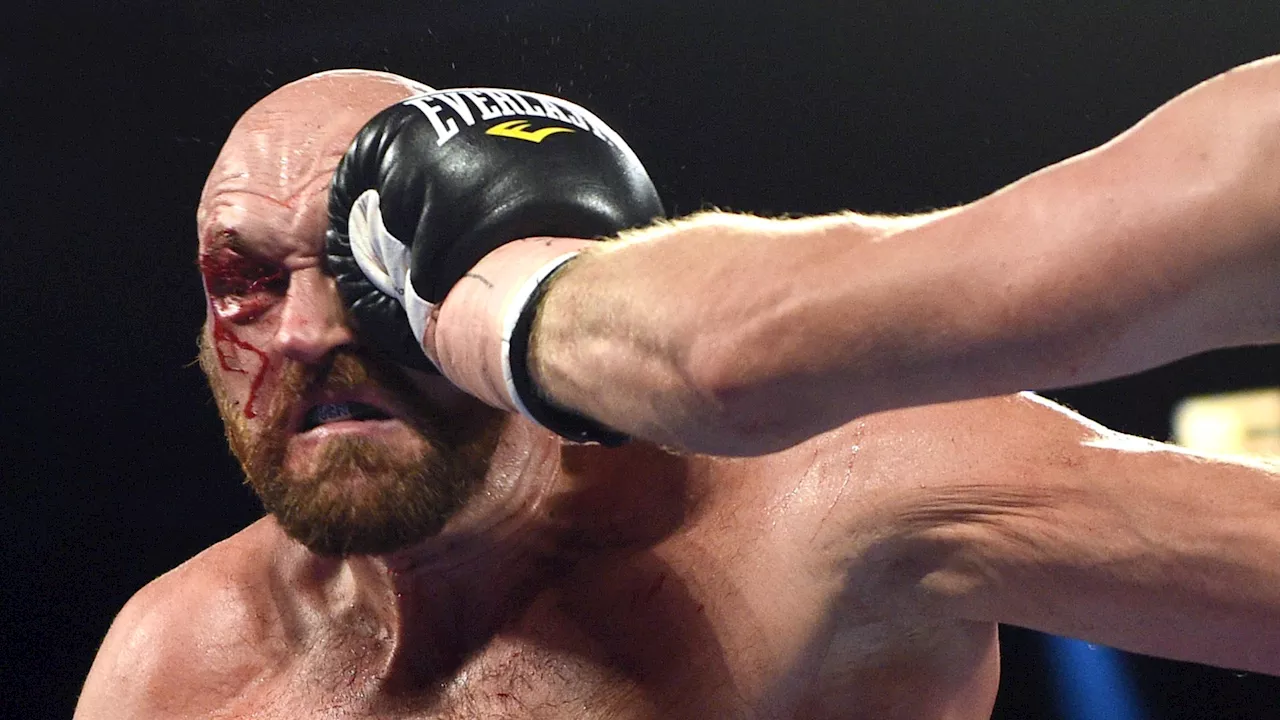 Derek Chisora to face boxer who left Tyson Fury requiring plastic surgery and 47 stitches after Jarrell...