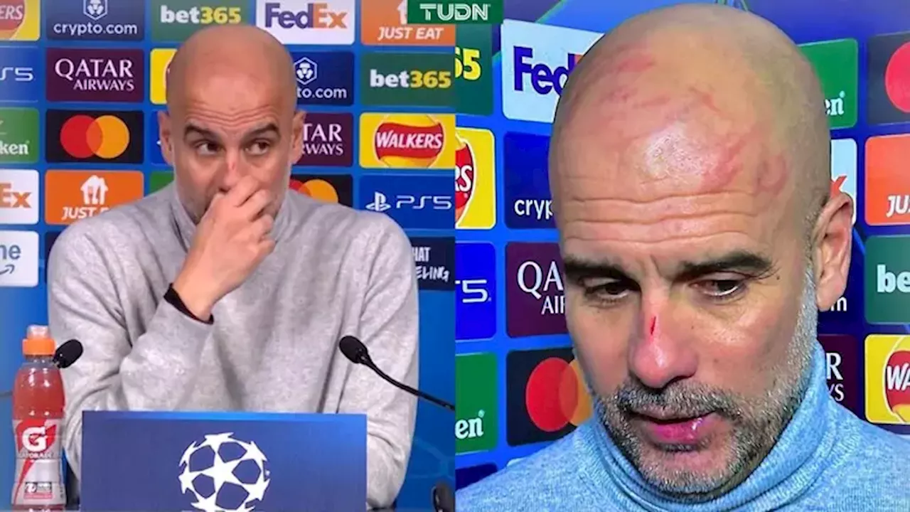 Pep Guardiola se lastima solo durante el juego del Manchester City en Champions