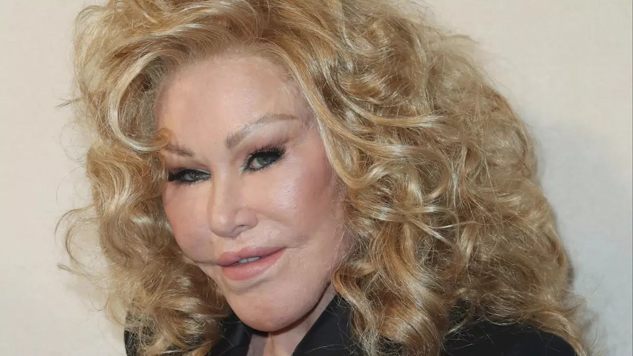 Jocelyn Wildenstein Warns Against Botox and Fillers