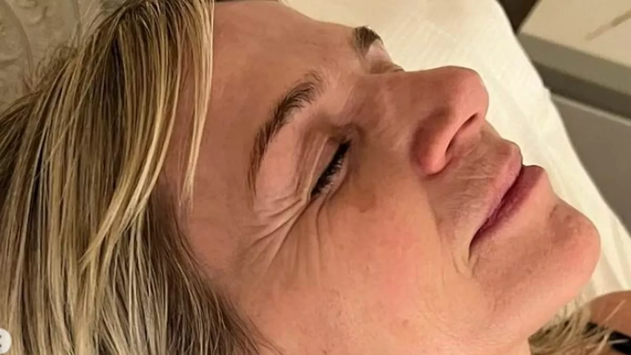 Zoe Ball Reveals TMJ Struggle, Shares Relief Through Facial Treatment