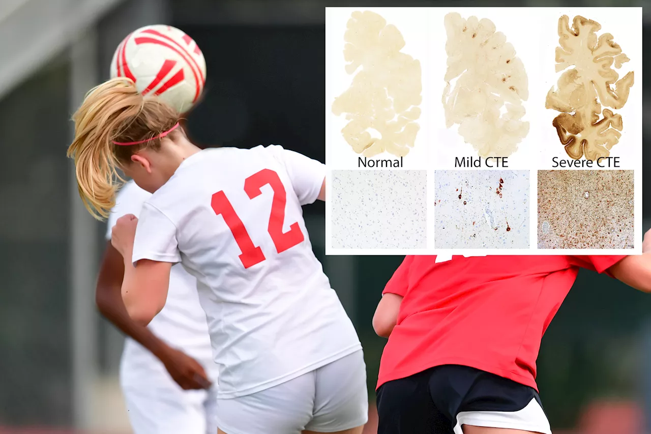 Common move used in soccer may brain damage akin to CTE: study