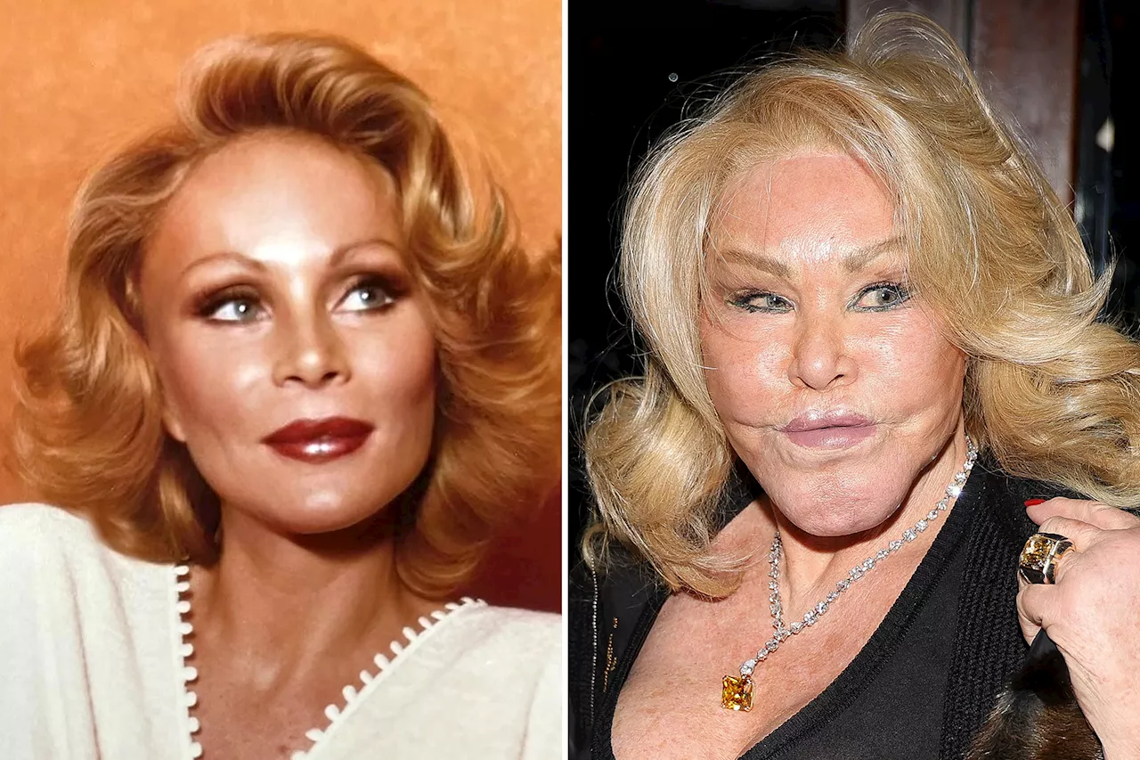 Jocelyn Wildenstein Denies Plastic Surgery Claims, Insists She Remains a 'Virgin' to Procedures