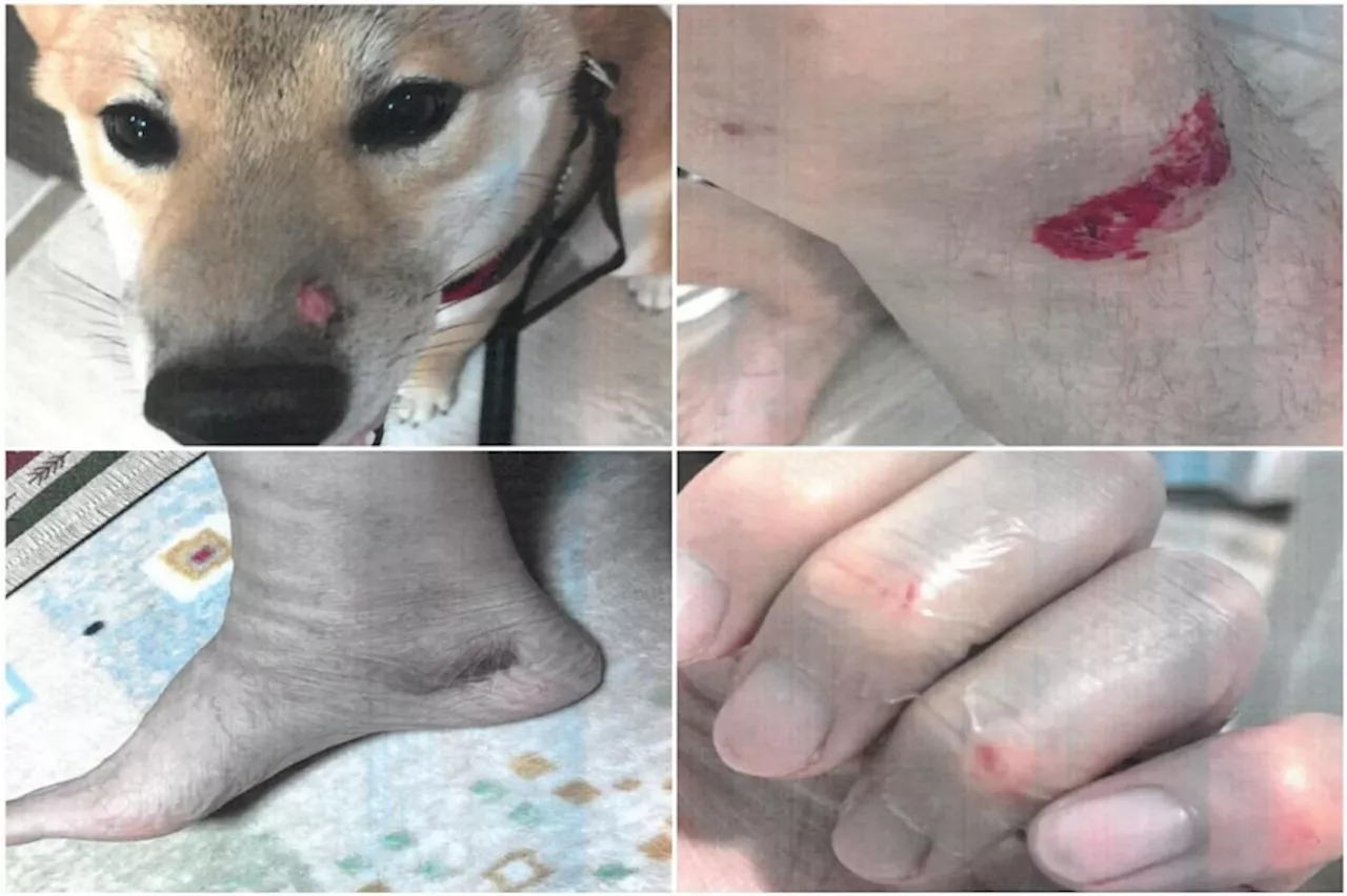 Singapore Man Fined $4,500 for Unleashed Bull Terrier Attack