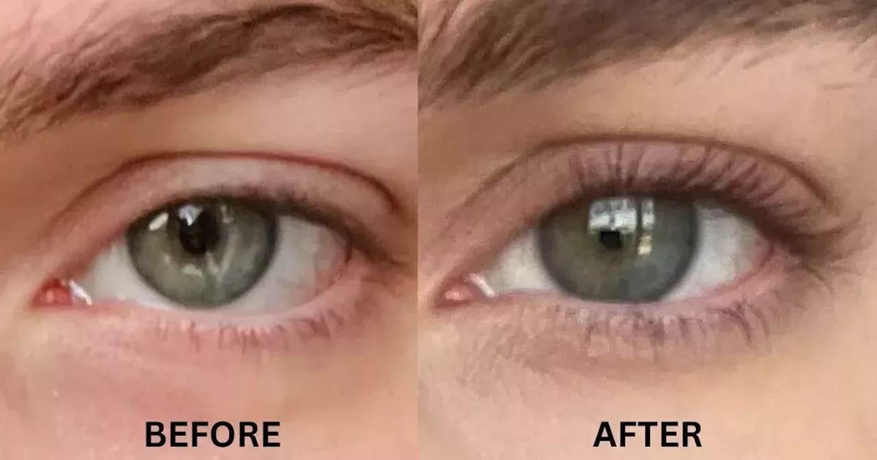 I doubled my eyelashes in three months using serum now £10 off