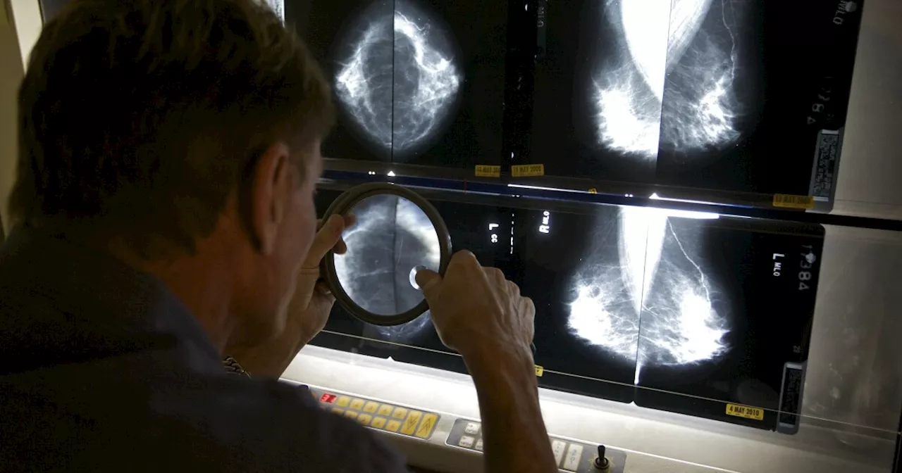 Early Detection: New grant will help U of A Health Sciences fine-tune latest tool for screening breast cancer