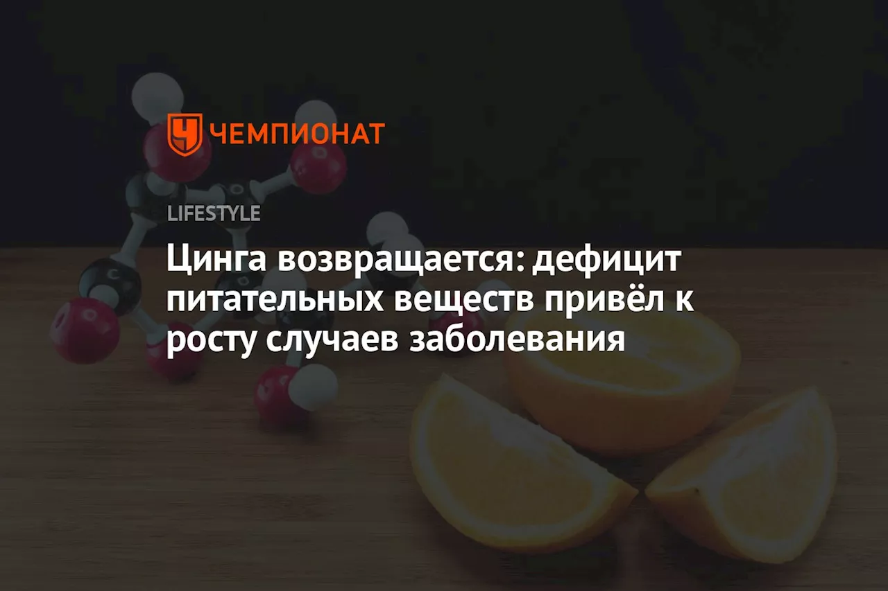 Цинга возвращается: дефицит питательных веществ привёл к росту случаев заболевания