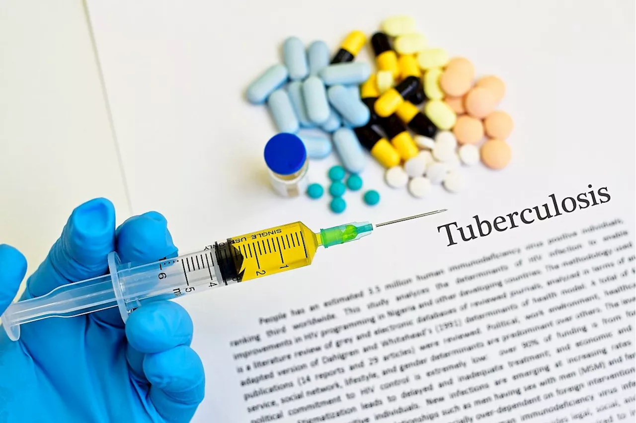 Tuberculosis cases hit record high in 2023