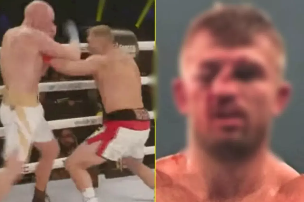 – Bare-knuckle boxer left with face entirely disfigured after brutal war...