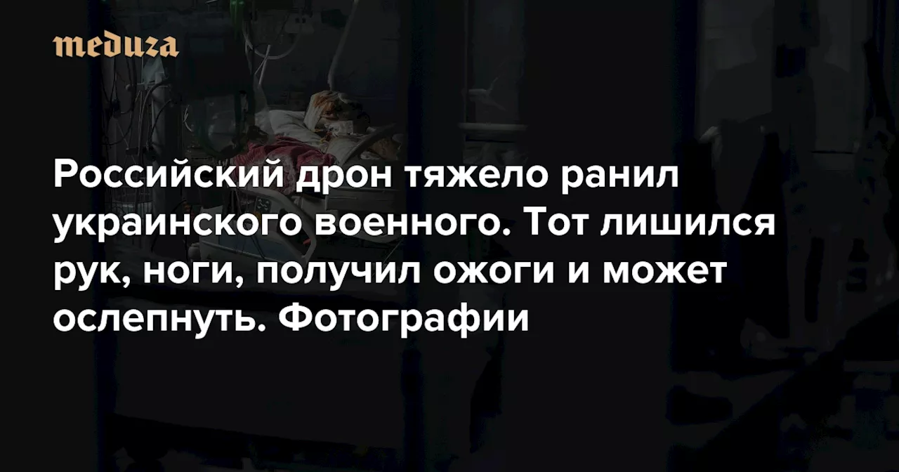 Российский дрон тяжело ранил украинского военного. Тот лишился рук, ноги, получил ожоги и может ослепнуть Фотографии — Meduza