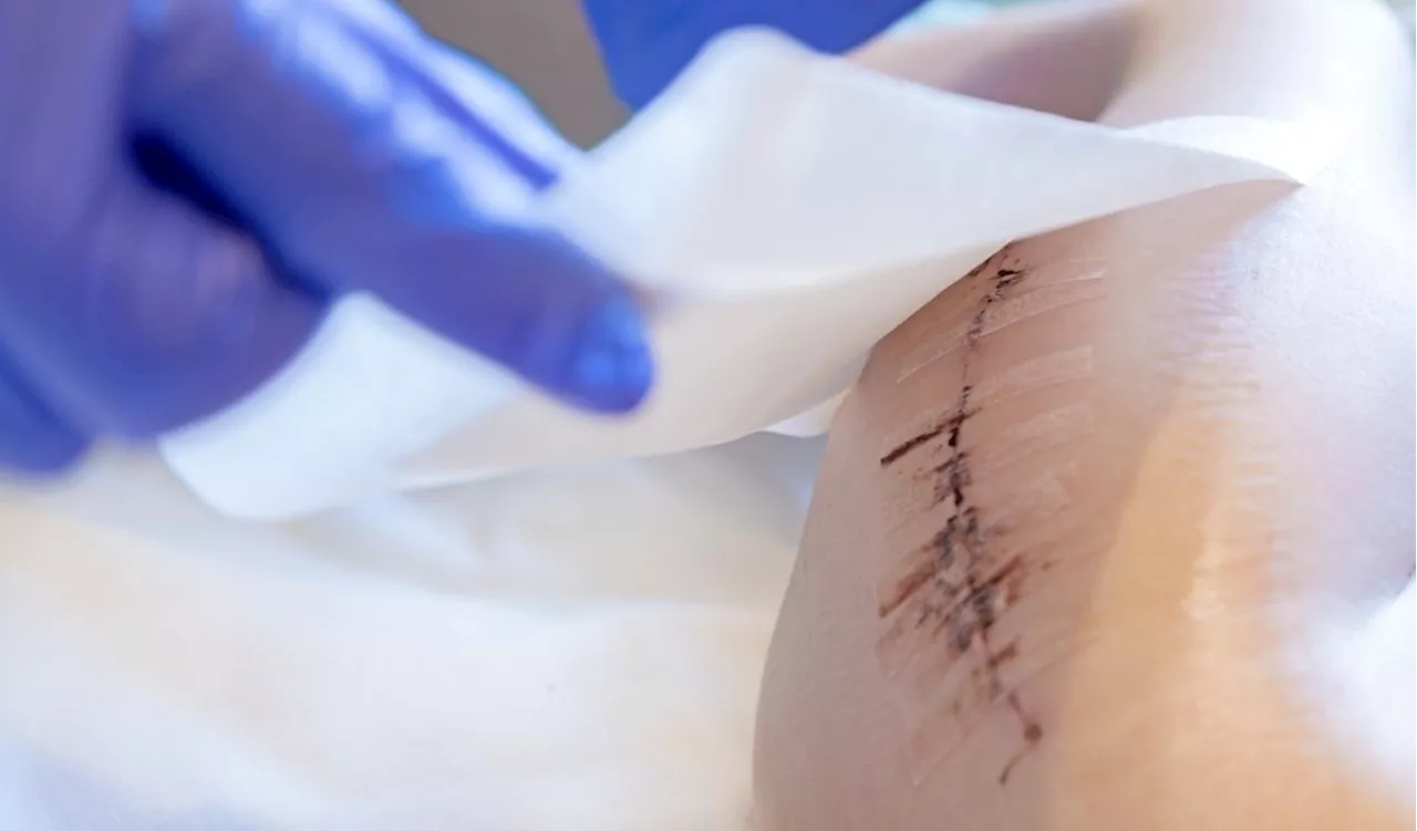 The Science Behind Silicone Scar Tape