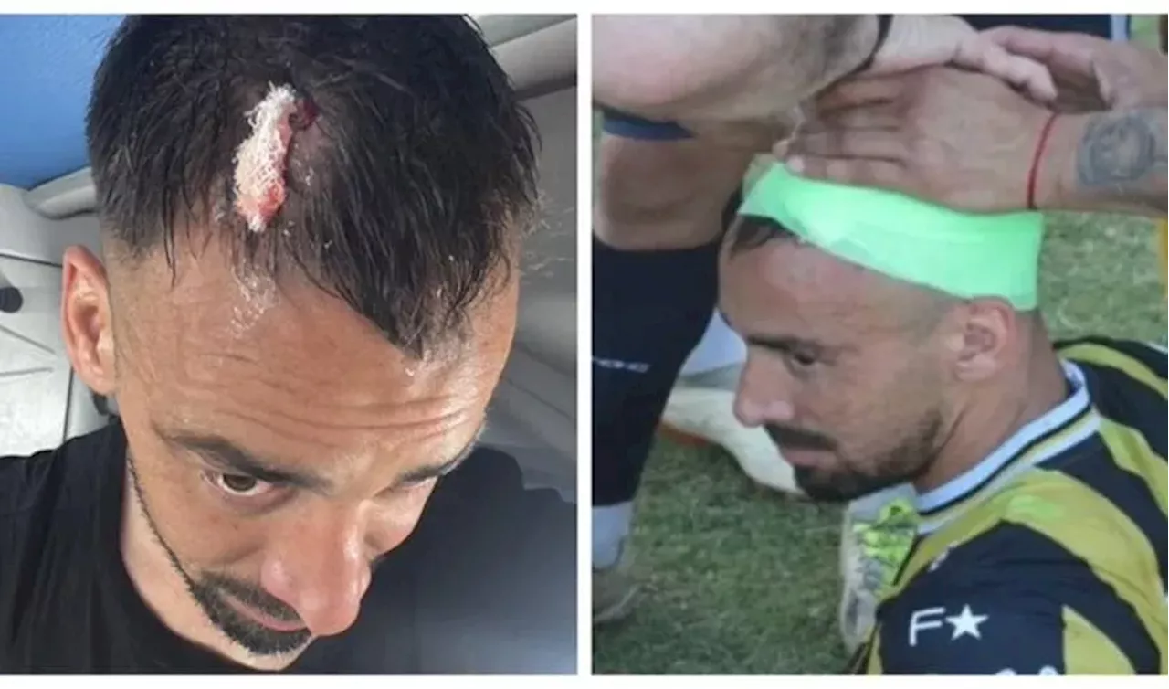 'Fue un choreo': hirieron de un piedrazo a un ex-River en el Federal A