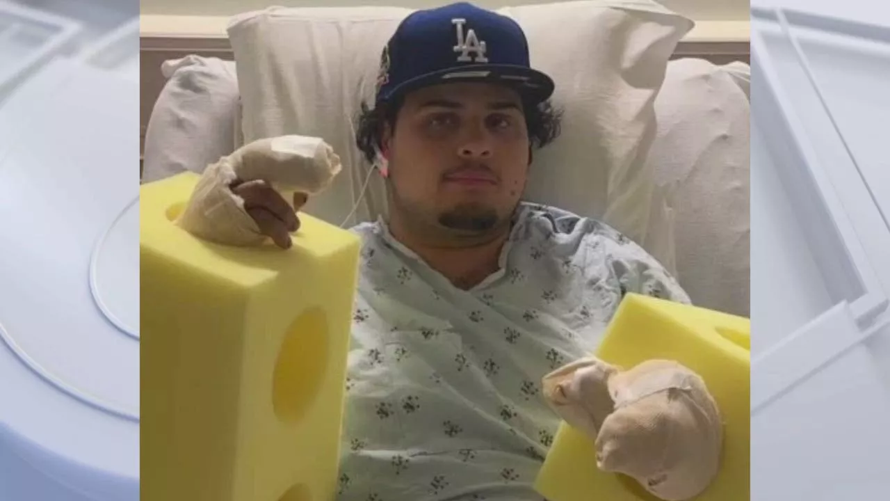 Dodgers fan loses fingers after firework blows up hand in downtown LA