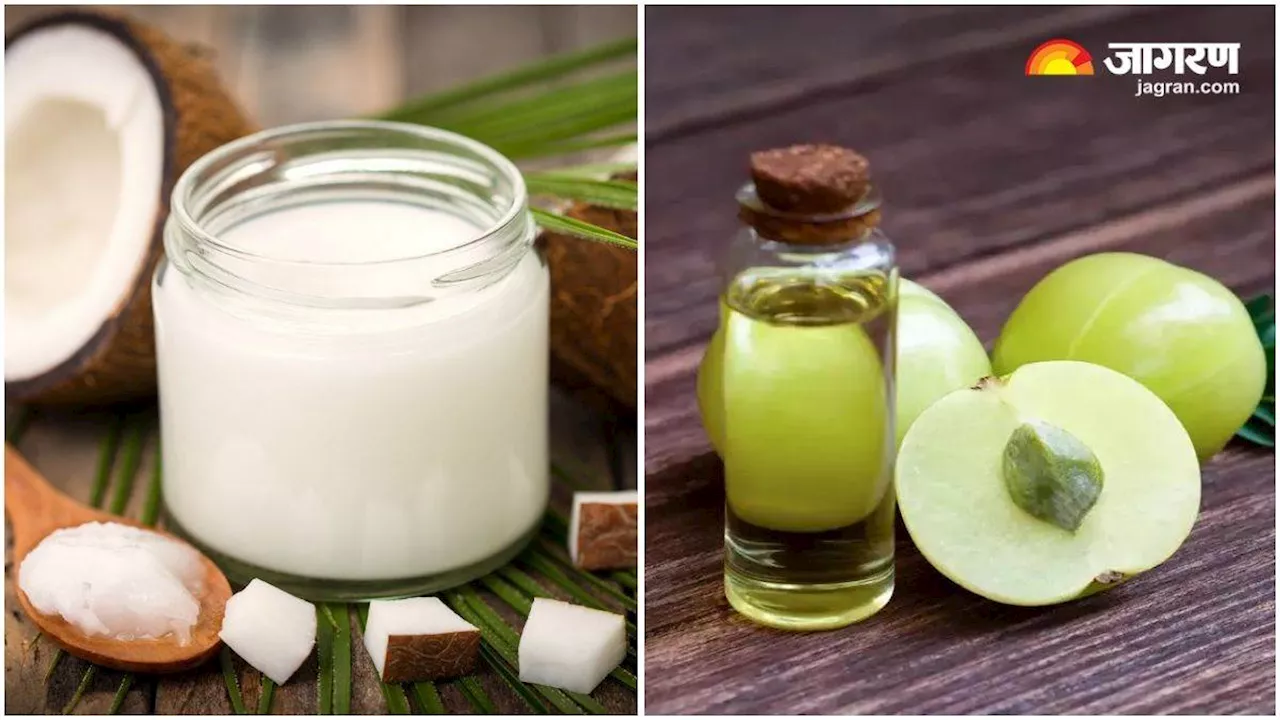 Coconut Oil Vs Amla Oil: नारियल या फिर आंवला, कौन-सा तेल है आपके बालों का सुपरहीरो?