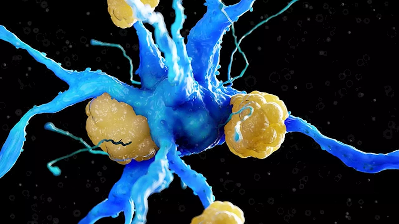 Experts Challenge New Diagnostic Criteria for Alzheimer’s