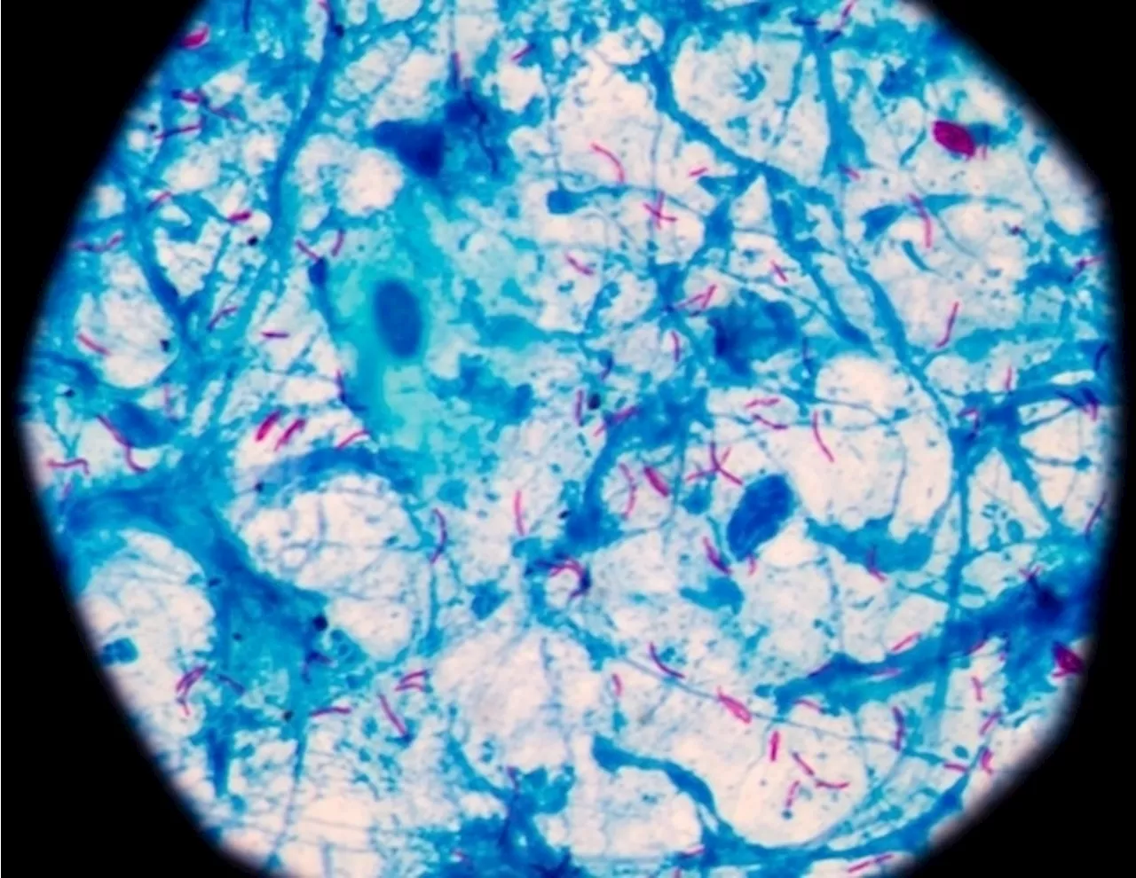 Deciphering the mechanisms of immune response with probabilistic graphical networks