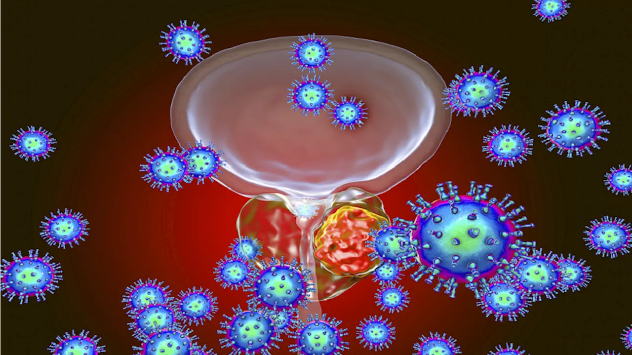 اختراق جديد في علاج سرطان البروستات العدواني