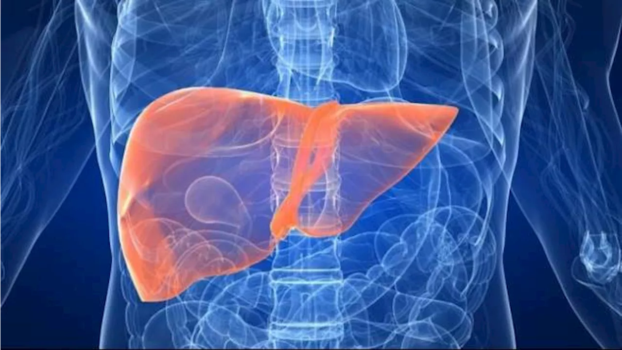 Apa Itu Fatty Liver dan Ini 4 Cara Cegah Kemunculannya