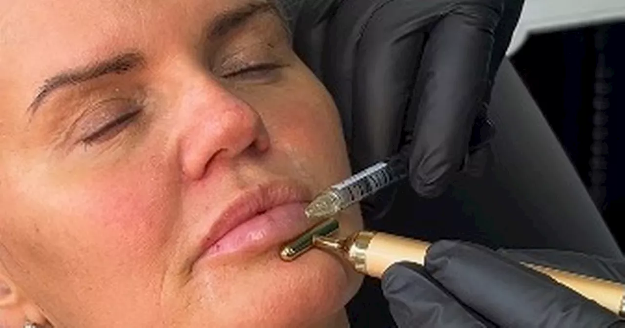 Kerry Katona fires back as she's compared to a duck after showing off new lips