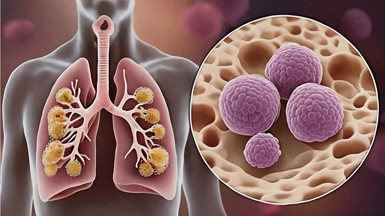 Berry-flavored vapes impair lung immune response