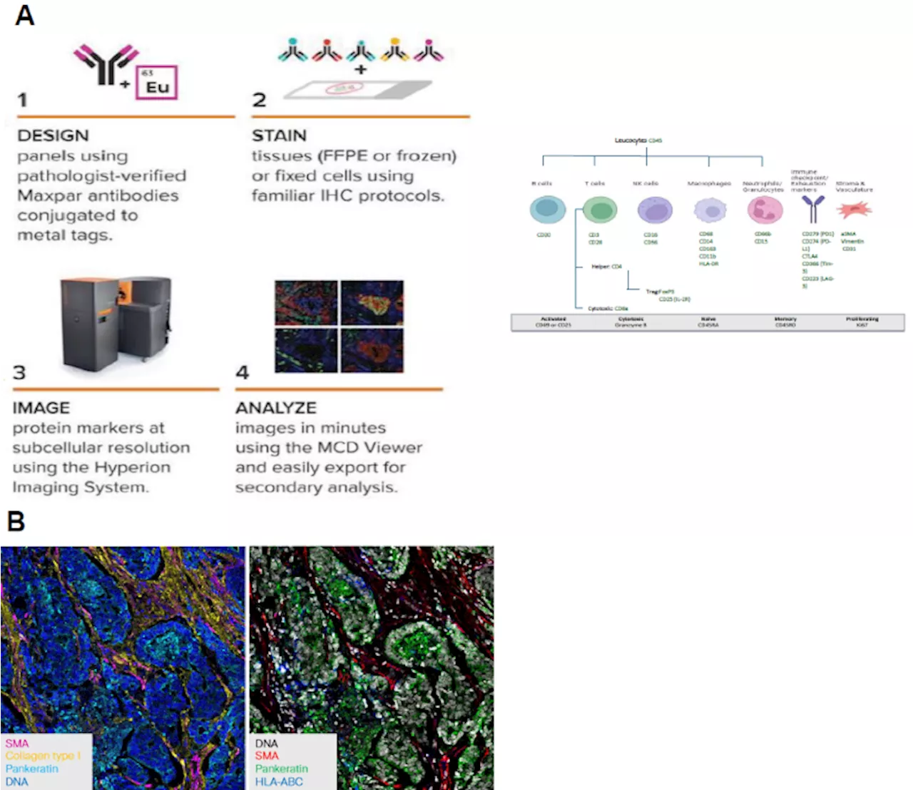 Uncovering novel therapeutic targets in immune checkpoint inhibitor resistance through spatial proteomics in metastatic tumor microenvironments