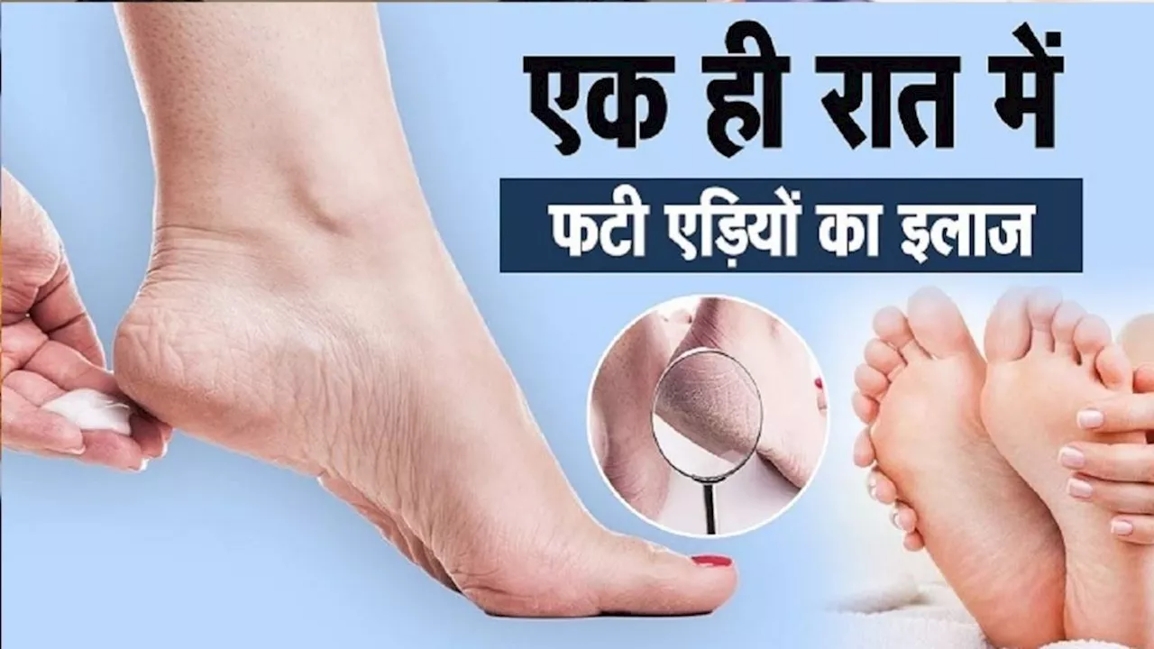 Foot Care: एक ही रात में ठीक होंगी फटी एड़ियां, सर्दियां आने से पहले करें यह उपाय