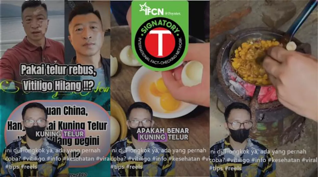 Keliru, Klaim Olesan Minyak Kuning Telur Bisa Atasi Vitiligo