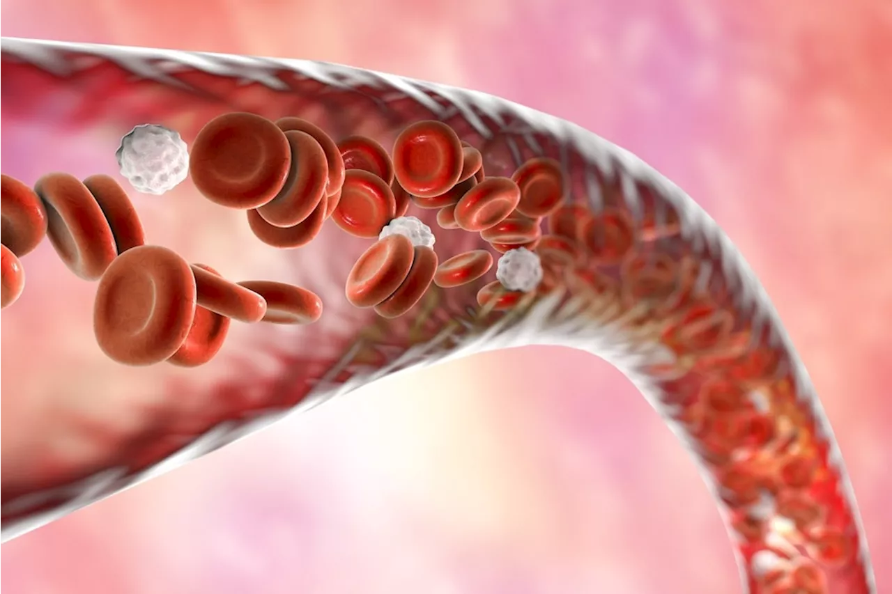 Key kinase involved in cell division linked to abnormal blood vessel growth in genetic disorder