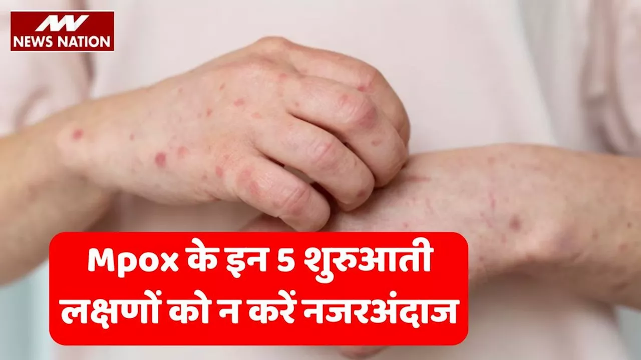 Mpox Early Symptoms: तेजी से फैल रहा है Mpox, इन 5 शुरुआती लक्षणों को न करें नजरअंदाज