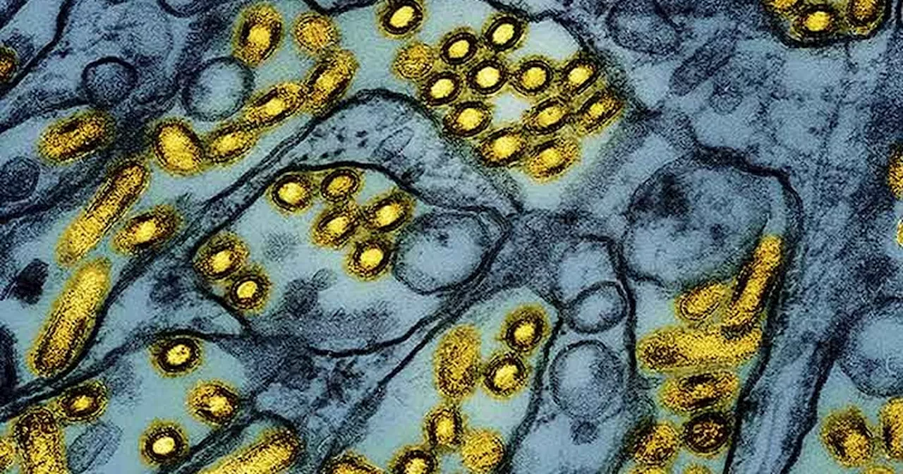 CDC calls for expanded testing for bird flu after blood tests reveal more farmworker infections