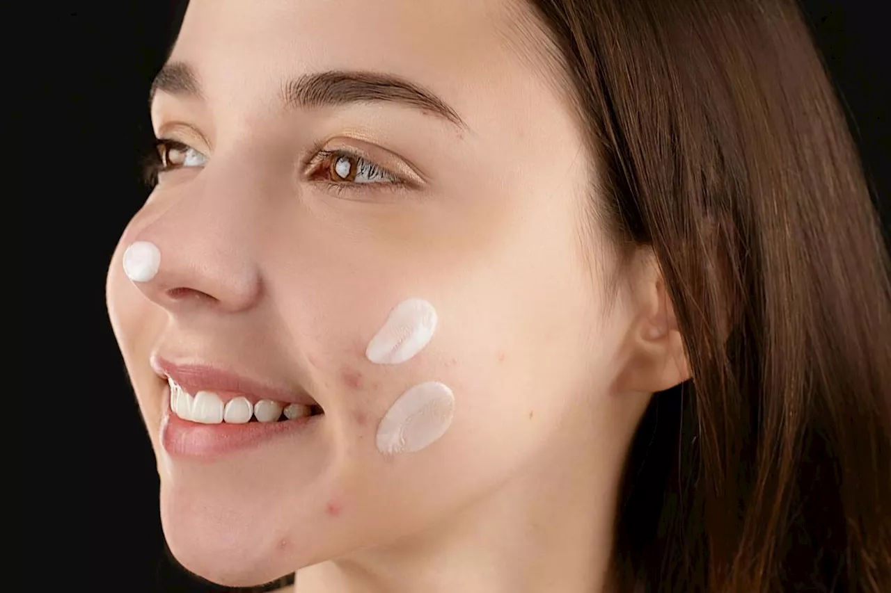 Acne Calming SPF 35: Pentingnya Tabir Surya untuk Kulit Berjerawat