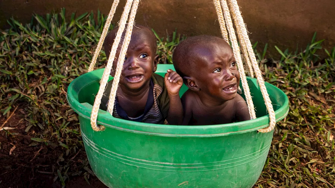 In Burundi: Kinder unterernährt, Mangelernährung trotz Weltvernetzung bleibt ein Problem