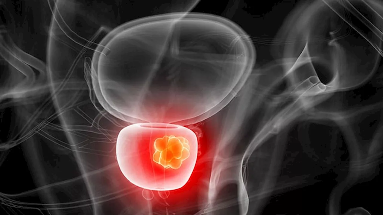 How Are Patients Managing Intermediate-Risk Prostate Cancer?