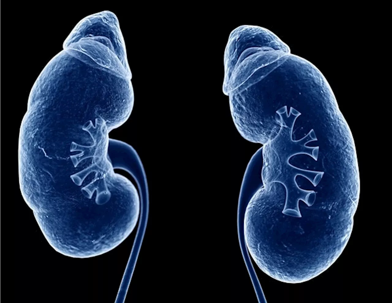 Scientists identify potential therapeutic targets for diabetic kidney disease