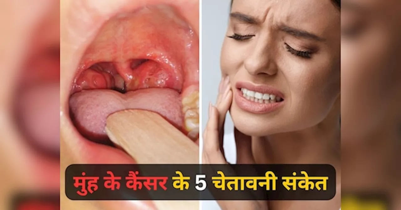 Mouth Cancer Symptoms: सांसों में अजीब बदबू से लेकर घाव तक, मुंह में इस तरह मिलते हैं कैंसर के 5 चेतावनी संकेत