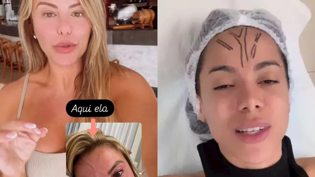 Poliana Rocha se identifica com Anitta e diz também ter veia aparente na testa