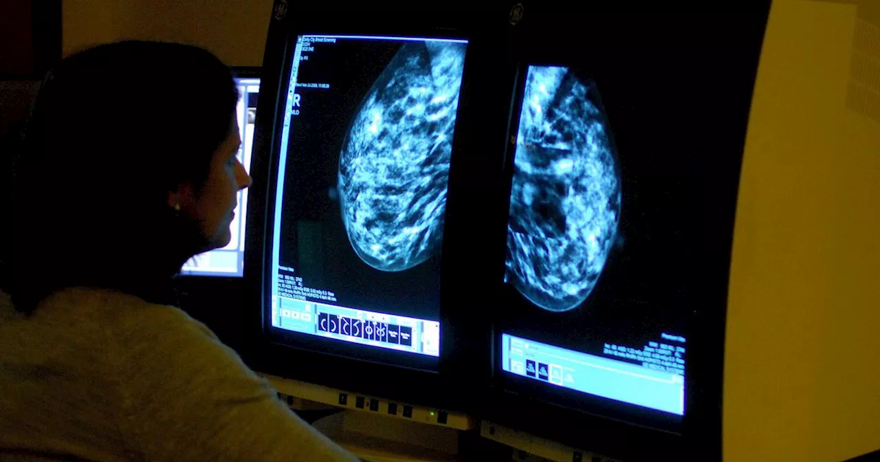 Breast cancer 'can be spotted at earliest stages thanks to new blood test'