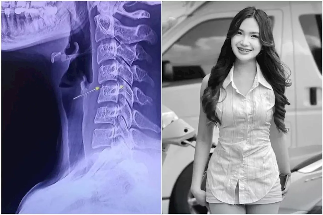 Masseuse asks to tell her side of story after Thai singer linked to neck-twisting massage dies