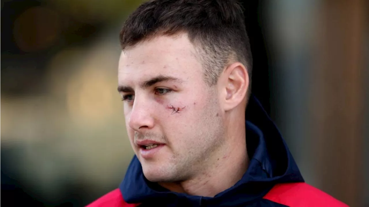 Roosters playmaker Sandon Smith pleads guilty after man loses two toes in ‘terrible accident’