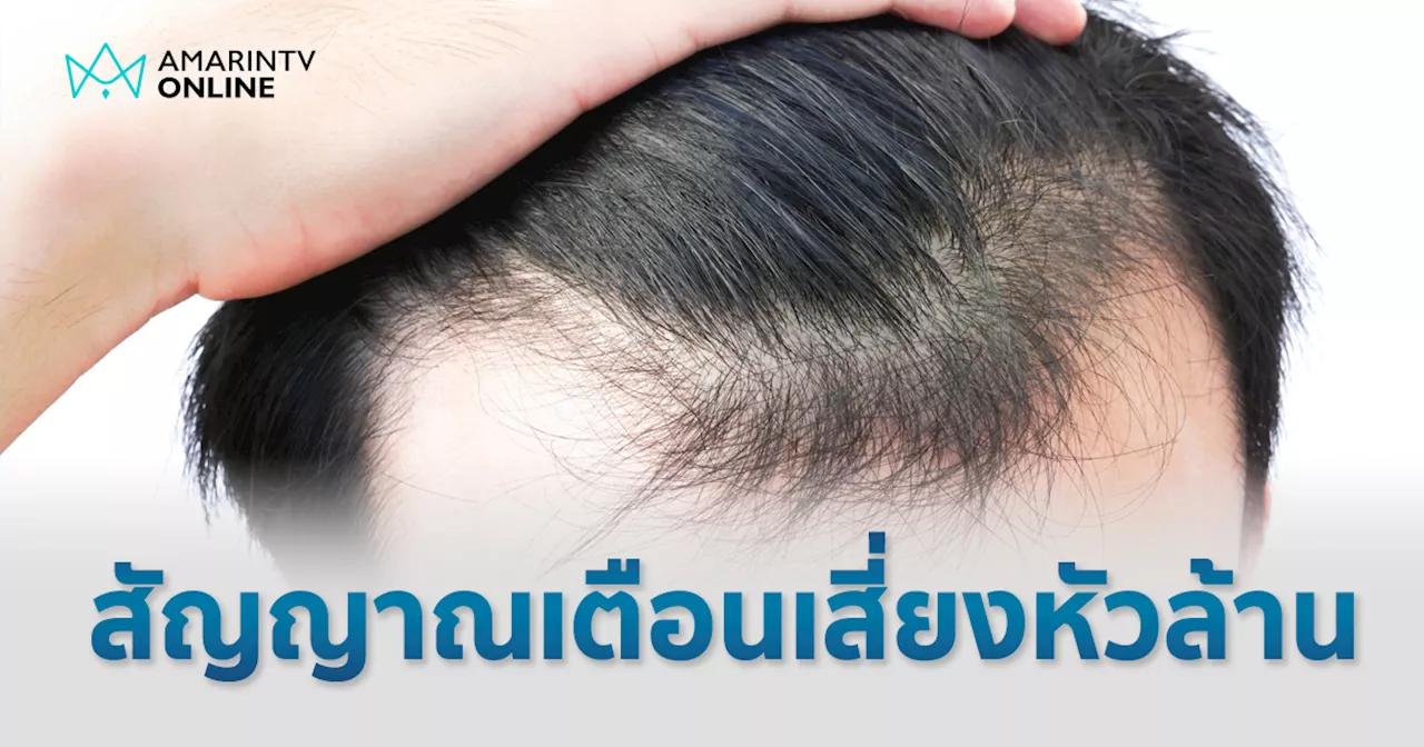 พฤติกรรมแบบไหนเสี่ยงหัวล้าน จริงหรือไม่ ผงชูรสเป็นตัวการทำให้ผมร่วง