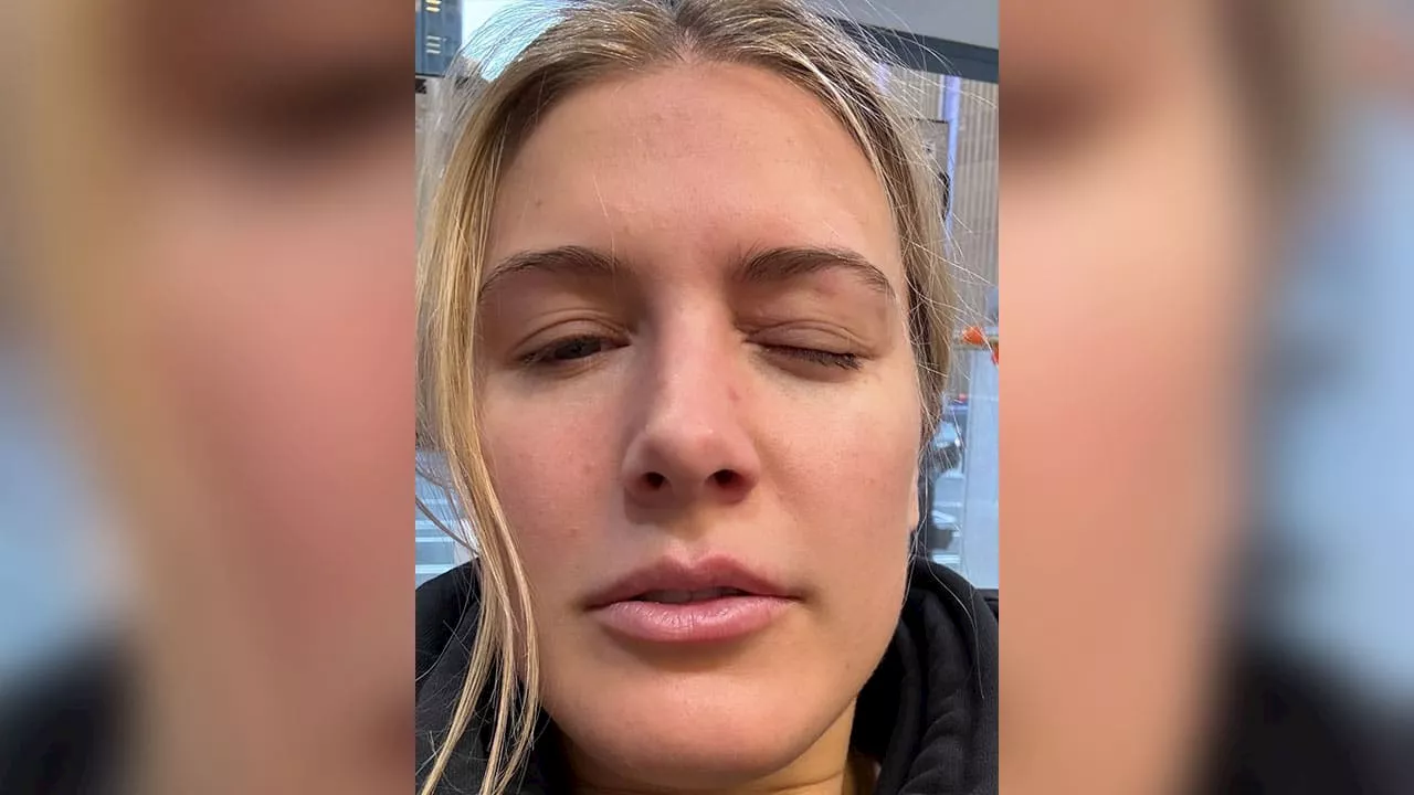 Notaufnahme! Tennis-Beauty Bouchard am Auge verletzt