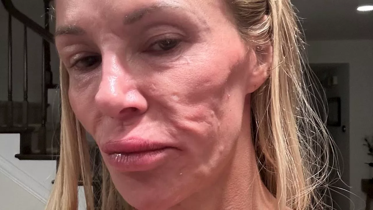 Botched surgeon issues urgent warning to Brandi Glanville and shares new theory about her 'parasite'...