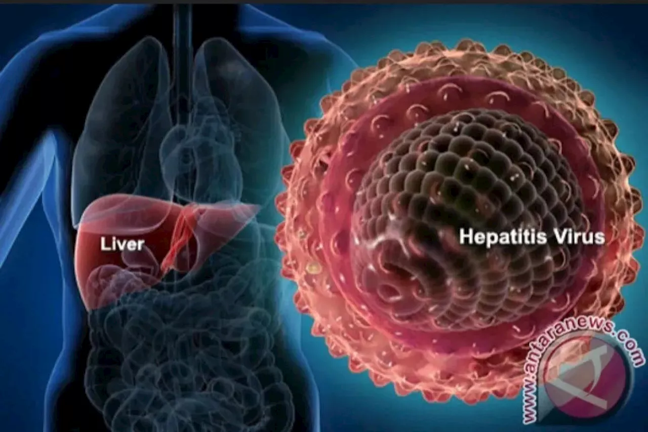 IDI Woha Bagikan Informasi Pengobatan Mengenai Penyakit Hepatitis