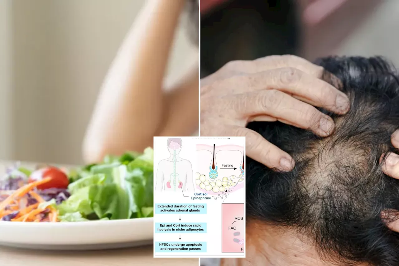 This popular diet might be slowing your hair growth, says new study