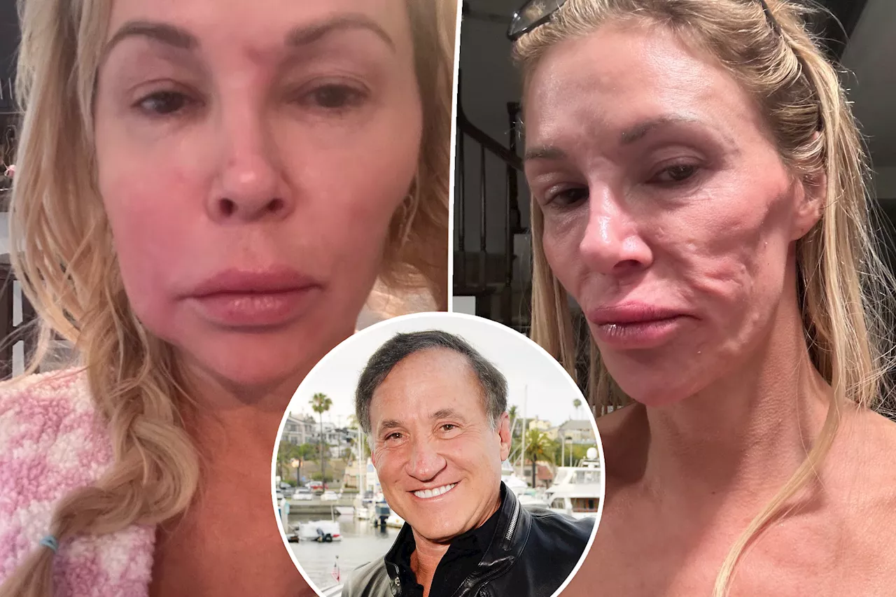 Dr. Terry Dubrow calls Brandi Glanville's face a 'ticking time bomb,' offers help