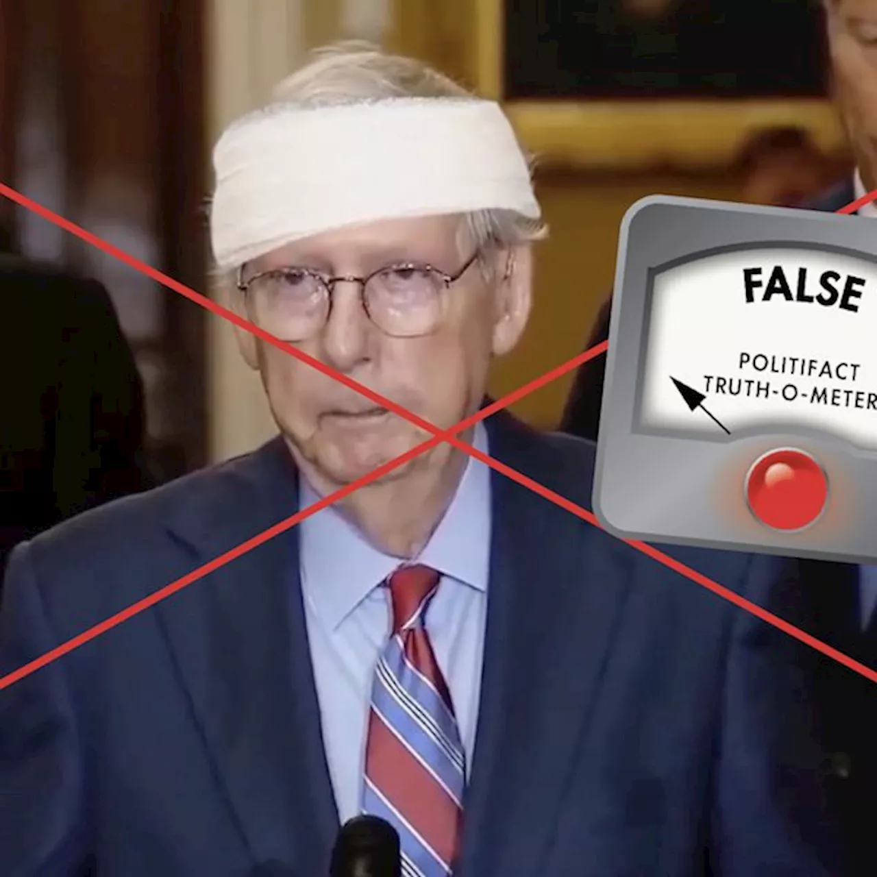 Video of Mitch McConnell with a bandaged head is edited