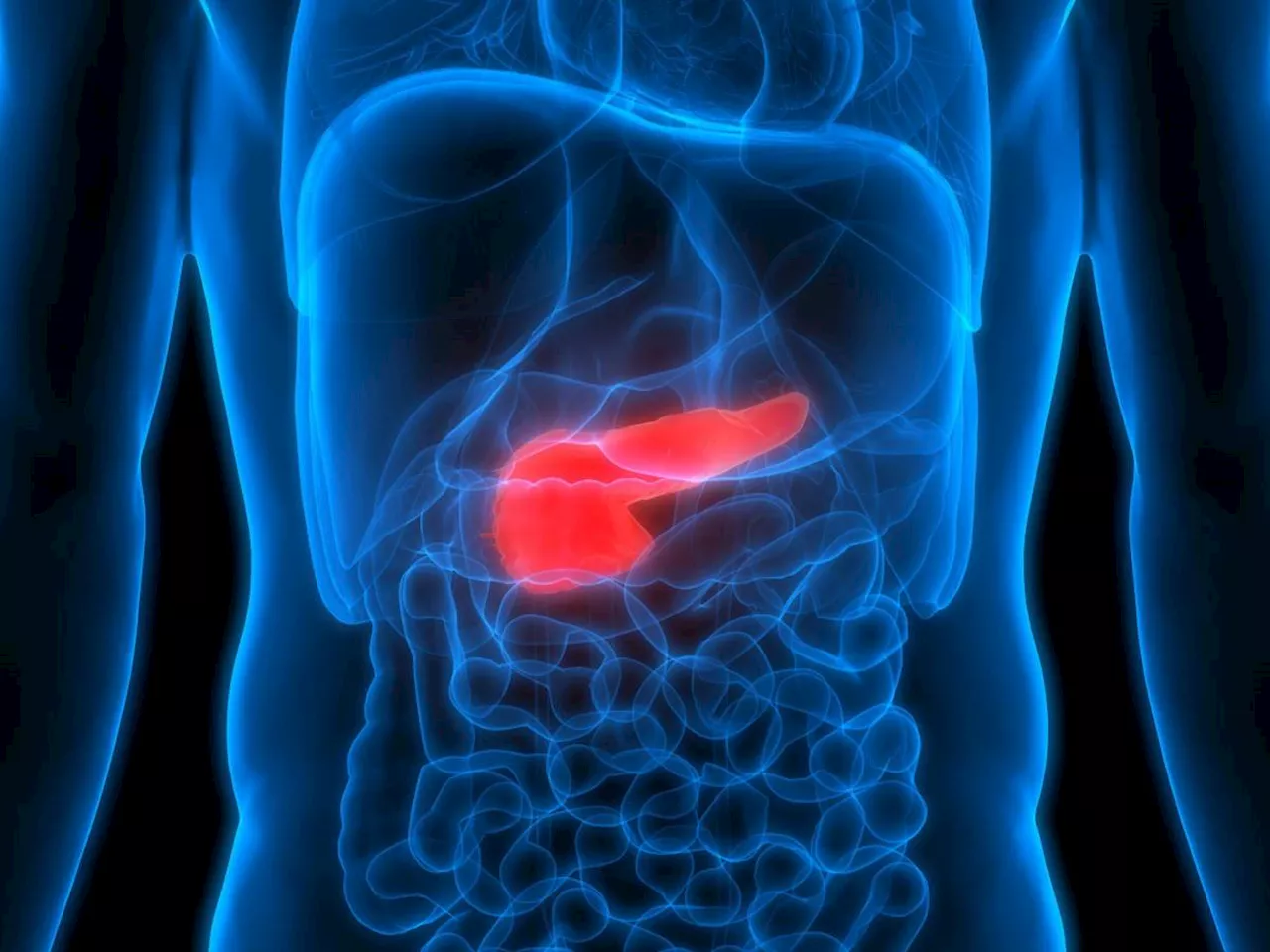 Tumore del pancreas, per la prima volta individuate le lesioni precancerose con una risonanza