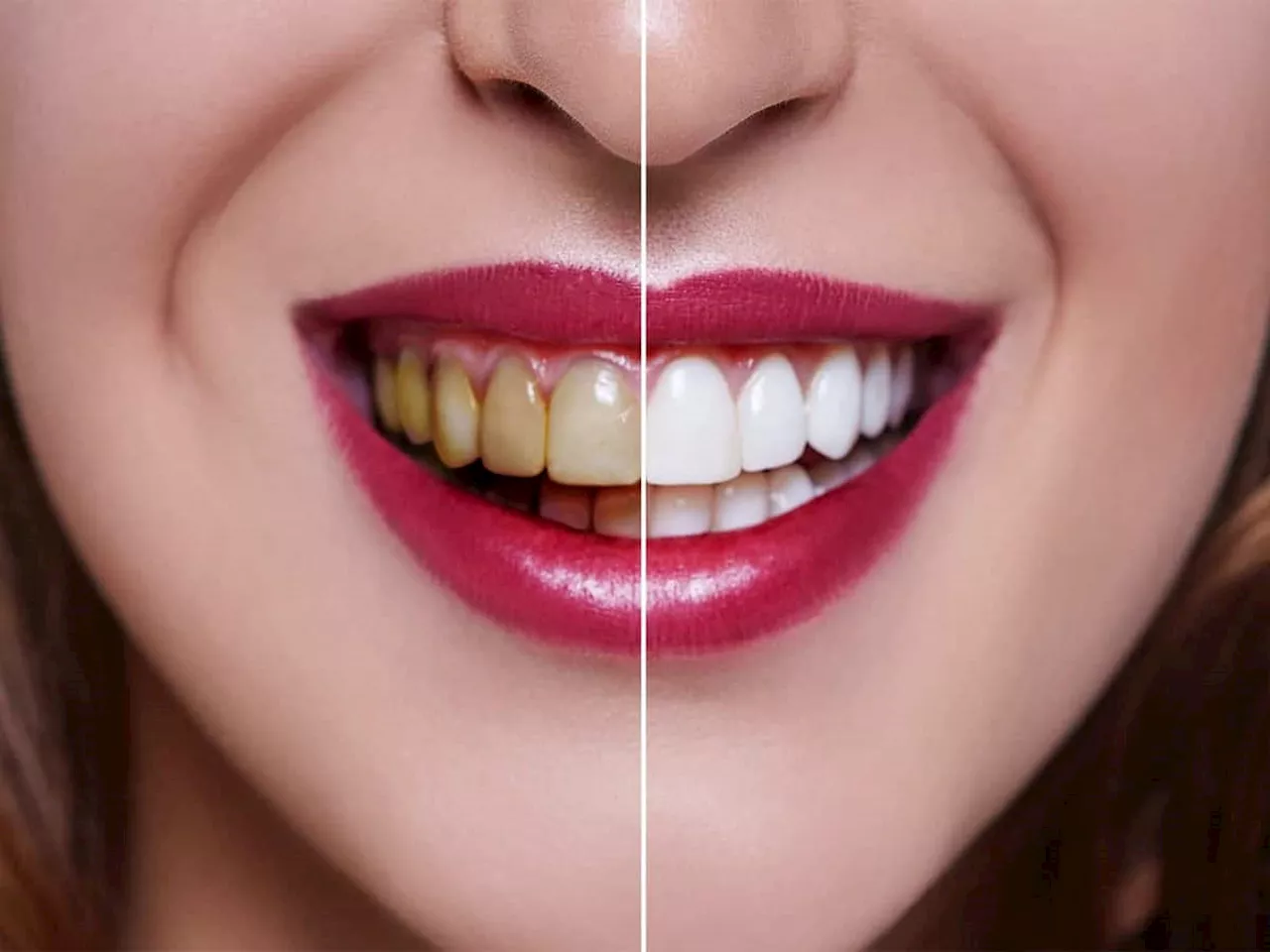 Teeth Whitening Tips: મોતી જેવા સફેદ ચમકતા દાંત માટે અજમાવી જુઓ આ સરળ ઘરેલુ નુસખા