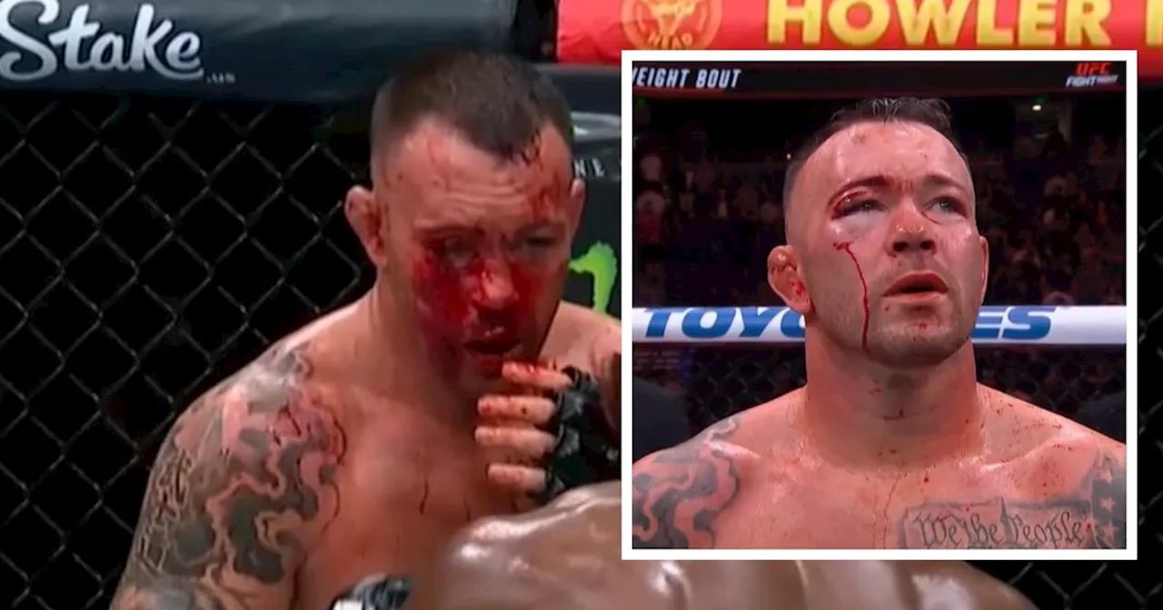 UFC: Colby Covington y su rostro desfigurado tras ser brutalmente golpeado por Joaquin Buckley (VIDEO)