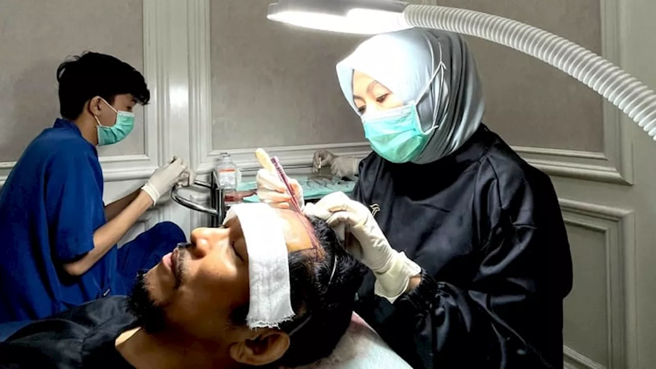 Teknologi Hair Transplant Indonesia Tidak Kalah Canggih dari Negara Lain